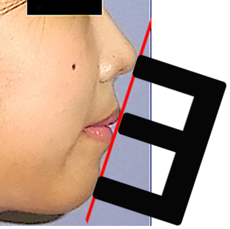 E Line 小顔整形 輪郭整形専門の美容外科 銀座フェイスクリニック