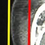 ct_inspection%e3%81%ae%e3%82%b3%e3%83%92%e3%82%9a%e3%83%bc