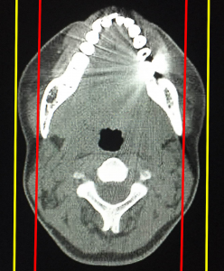 ct_inspection