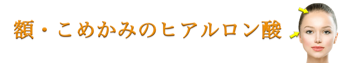 おでこ・こめかみのヒアルロン酸バナー