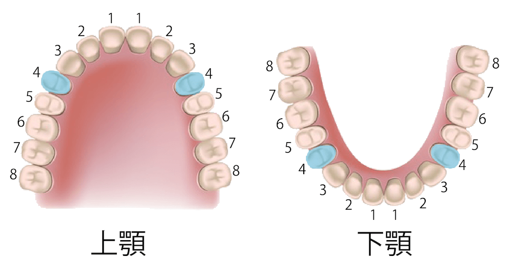 上下左右の4番目を抜歯します。