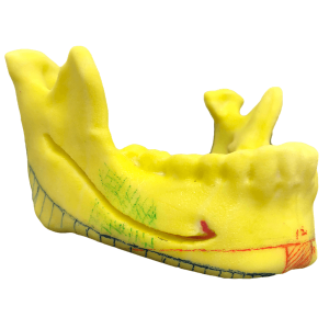 Vライン形成｜デザイン（3D骨格模型）