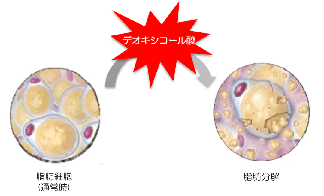 Kabelline（カベリン）｜推奨プラン