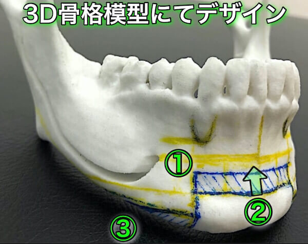 オトガイ削りのデザイン