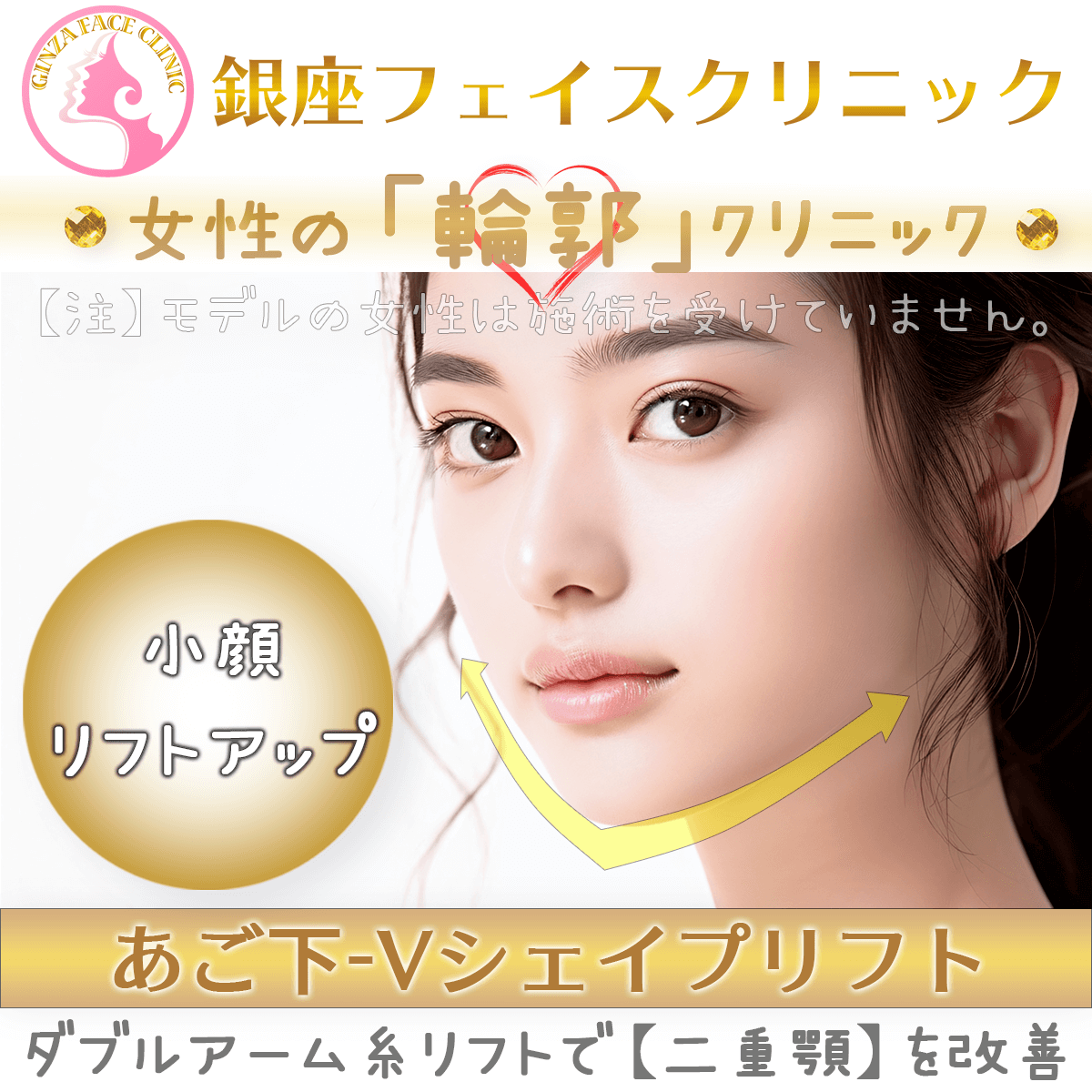 あご下Vシェイプリフト｜ダブルアーム糸で二重顎を改善