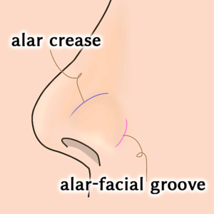 鼻翼を囲む2つの溝について｜銀座フェイスクリニック
