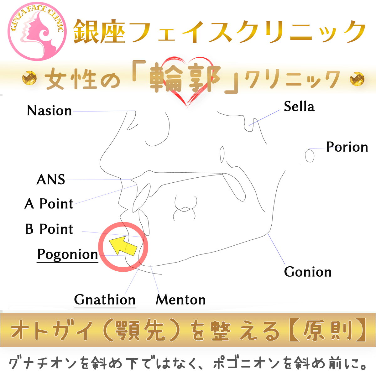 顎ヒアルロン酸を失敗しないためのポイント｜ポゴニオンを斜め前に