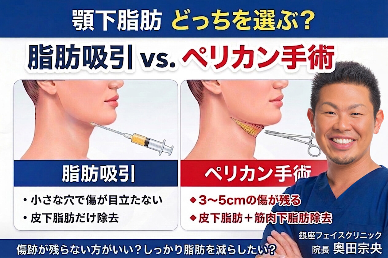顎下の脂肪吸引とペリカン手術どちらを選ぶべきか？