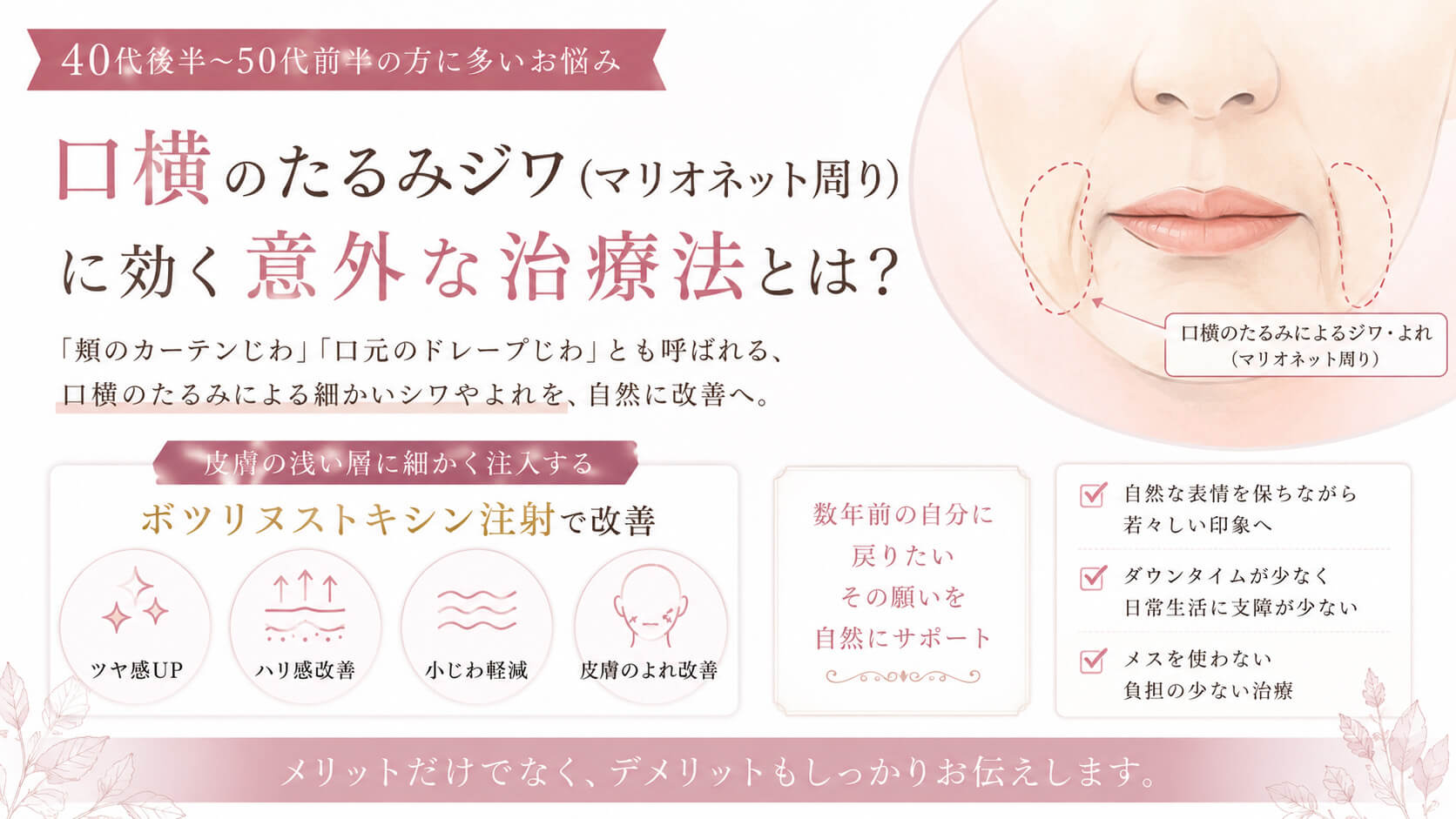 頬のカーテンじわ・ドレープじわを改善するボツリヌストキシン注射｜銀座フェイスクリニック