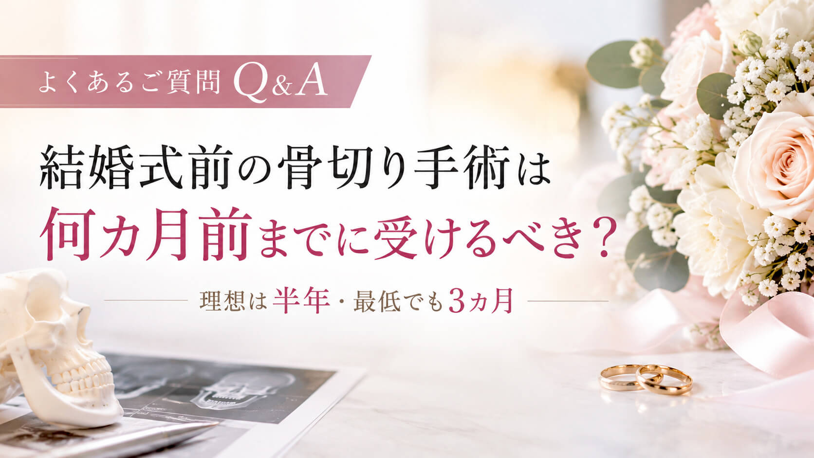 結婚式前の骨切り手術 Q&A