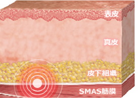 SMAS筋膜を刺激